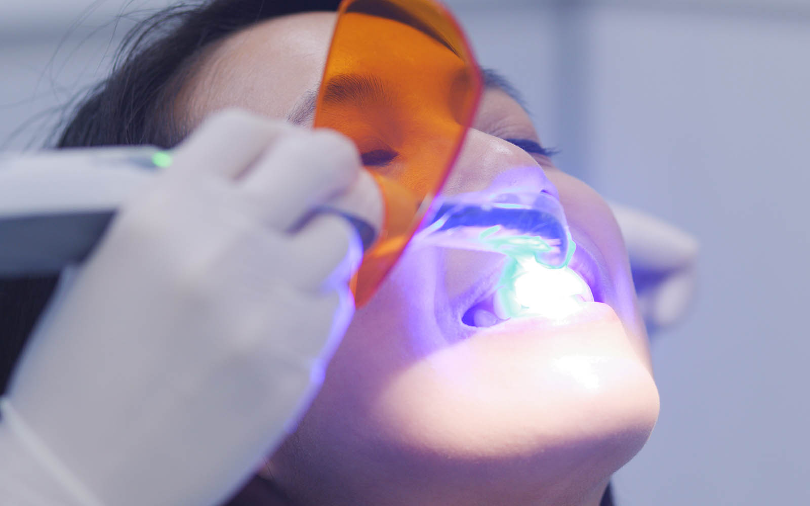 teeth-whitening-process.jpg